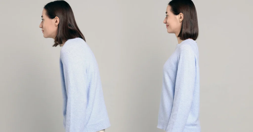 Woman demonstrating poor posture versus corrected posture side-by-side, showing the benefits of back strengthening exercises for better posture.